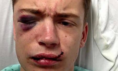 Young Man Beaten With a Beer Bottle for Being Gay