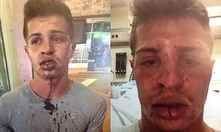 Young man beaten for kissing boyfriend at Burger King.