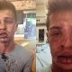 Young man beaten for kissing boyfriend at Burger King.