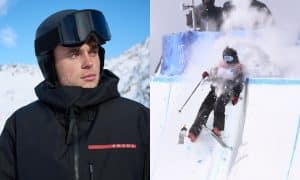 Gus Kenworthy Is 'Happy to Be Walking' Following Olympic Crash